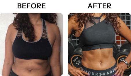 before and after results exopod lakeway ava